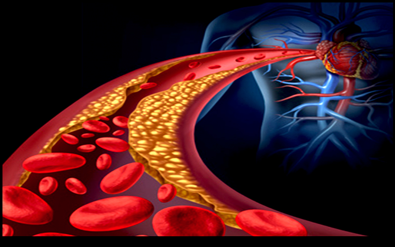 Koleszterin mítoszok: mit érdemes tudni?