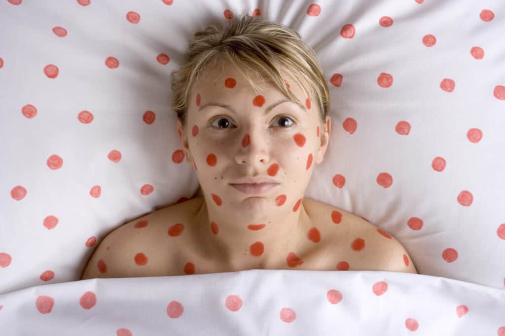 Bőrkiütés és viszkető foltok felnőtteknél – ekcéma vagy allergiás reakció?